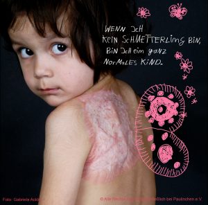 Aktionsbild